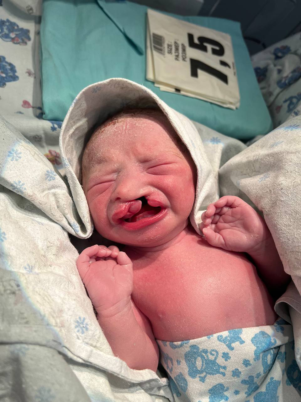 История Дианы и Иветты