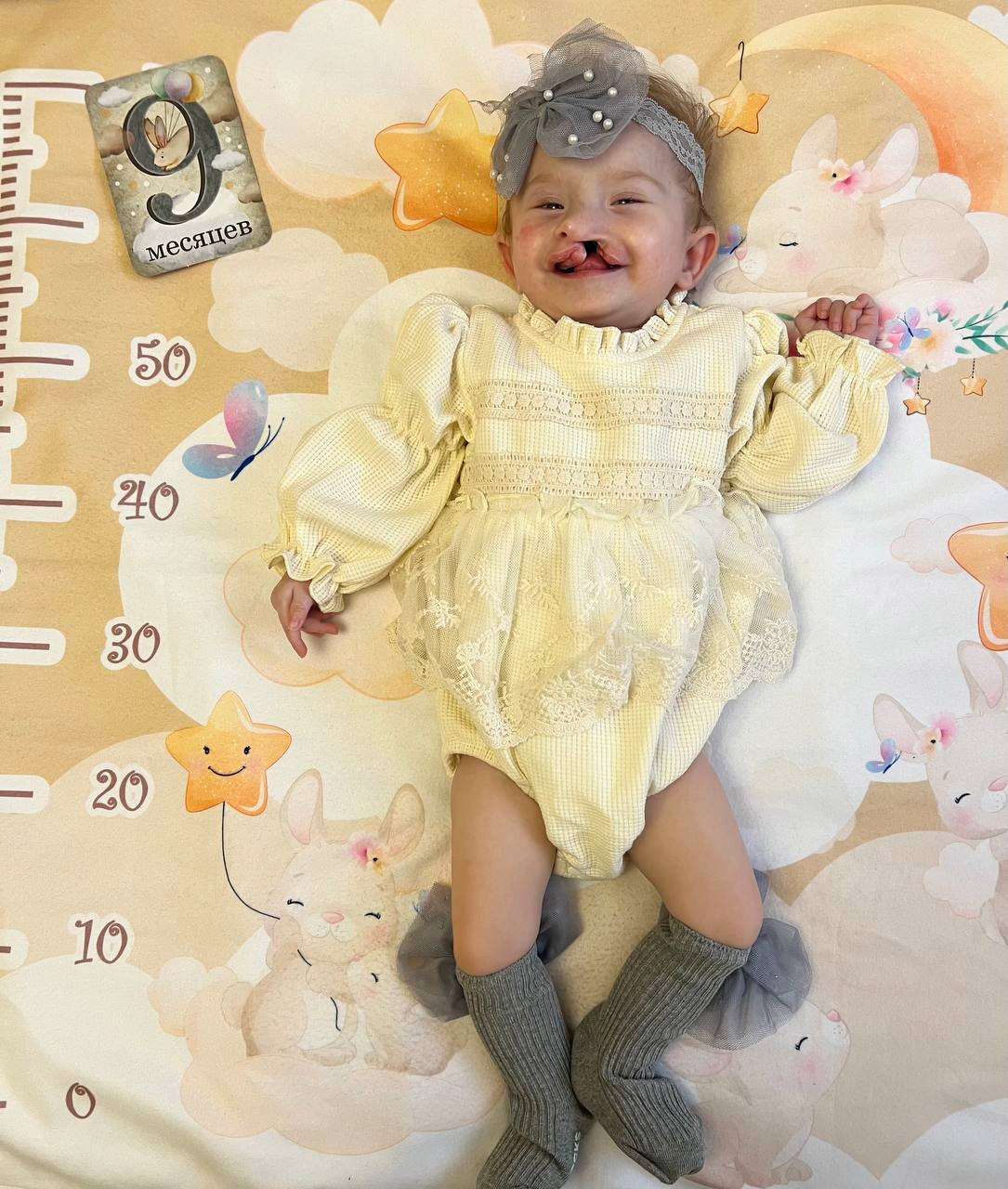 История Дианы и Иветты