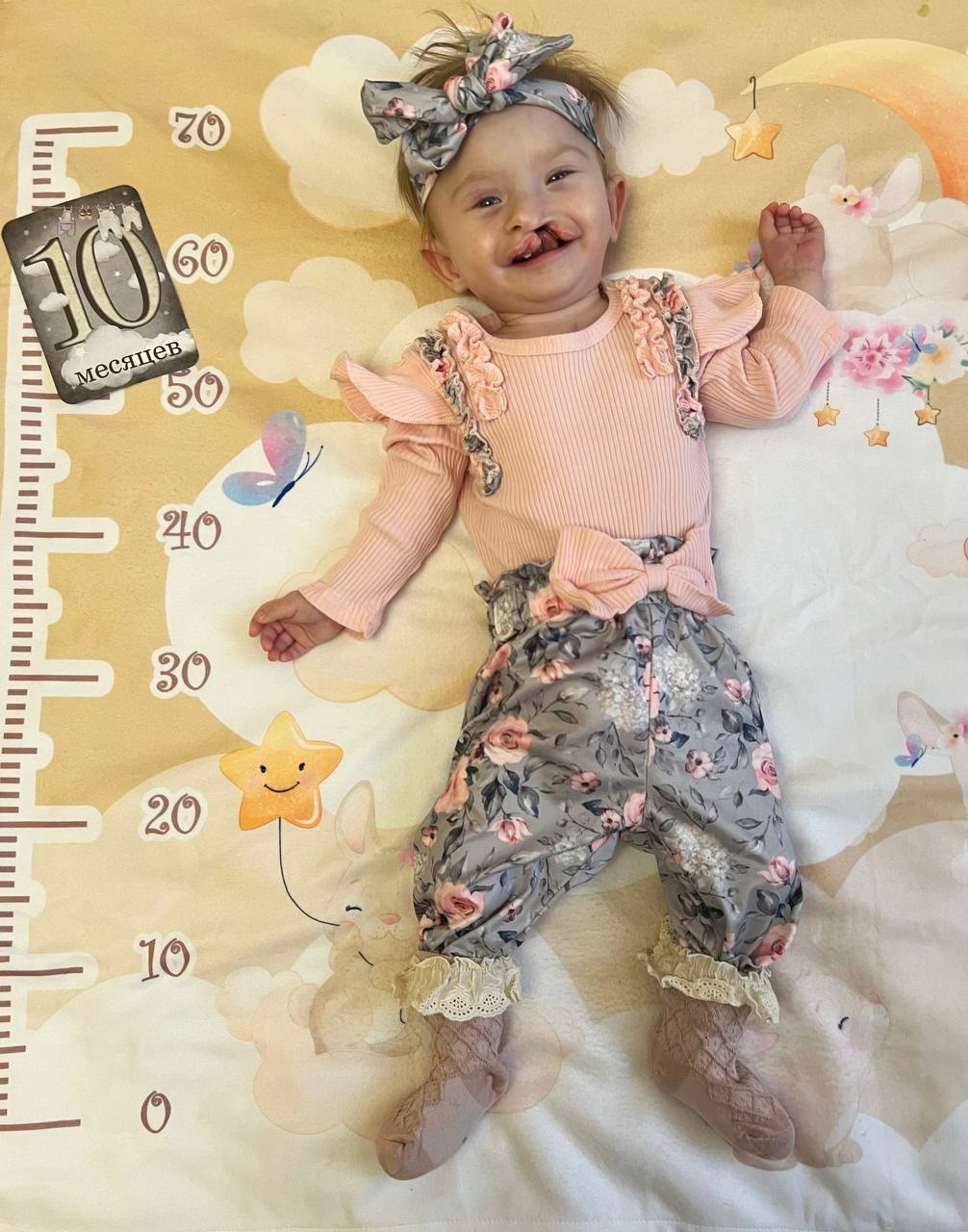 История Дианы и Иветты