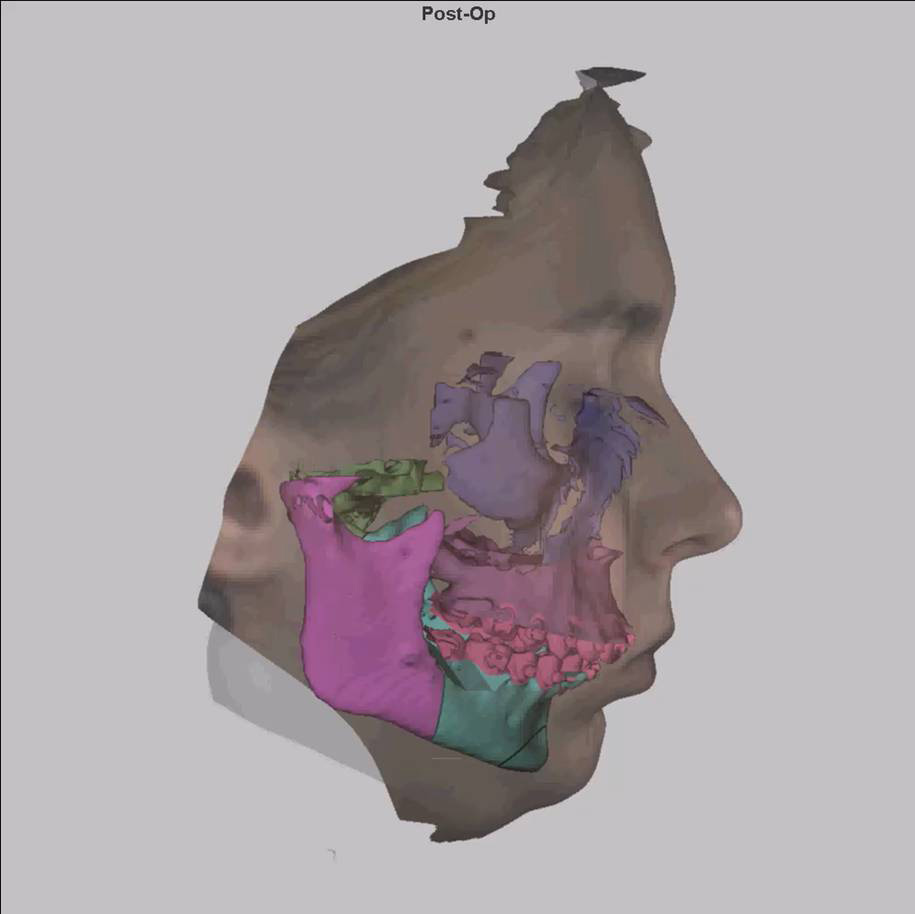 3D-моделирование в лечении челюстно-лицевых патологий