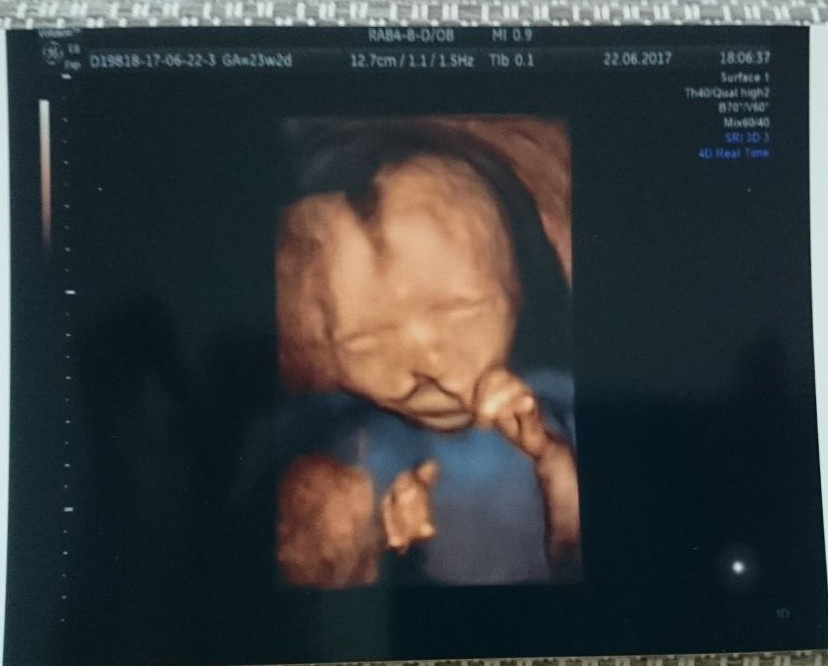 История Анны и Егора